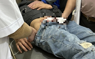 Nam thanh niên ở Quảng Bình nghi tự lấy kéo cắt "chỗ hiểm" đứt gãy