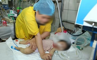 Bệnh sởi tăng đột biến trên thế giới, Việt Nam ghi nhận 42 ca