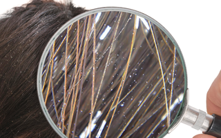 Hướng dẫn cách trị gàu ống hiệu quả, thực hiện 2 lần/tuần