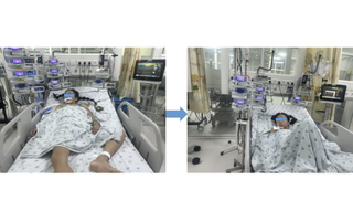 Bé gái ở An Giang mắc căn bệnh hiếm, với chưa đến 12 ca ở trẻ em được báo cáo trên y văn thế giới