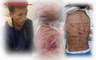 Lời kể kinh hoàng của bé gái lớp 5 bị cha dượng đánh đến không đi được
