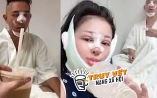 Bác sĩ Chiêm Quốc Thái phủ nhận làm biến dạng mũi Ngân 98