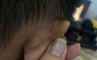 Giáo viên bị xử phạt vì bạo hành trẻ, phụ huynh đòi hoàn lại 1 năm học phí