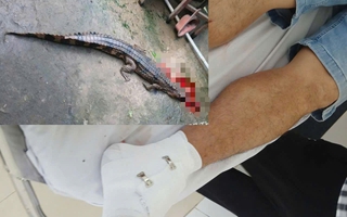 Thầy giáo ở Tây Ninh bị cá sấu sổng chuồng cắn vào chân