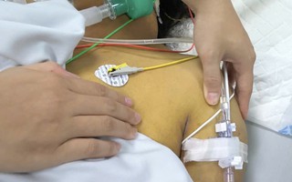Nữ công nhân nguy kịch do vi khuẩn lây lan mạnh mùa mưa lũ