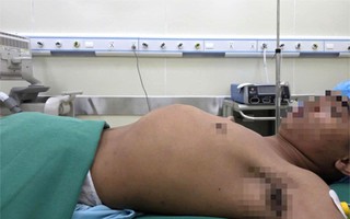 Thanh niên bị "bệnh lạ", tỉ lệ 1/1.000 người mắc