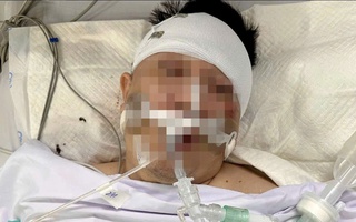 Luật sư lên tiếng vụ người đàn ông nguy kịch khi xe tông trúng chó chạy rông