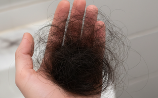 Rụng tóc ở người trẻ: Nguyên nhân phổ biến ít ai để ý