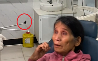 Ớn lạnh cảnh con đỉa sống trong mũi người phụ nữ suốt 3 tuần