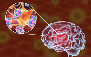 Báo Người Lao Động tổ chức talkshow: “Sự nguy hiểm của viêm màng não: Phát hiện, điều trị ra sao?