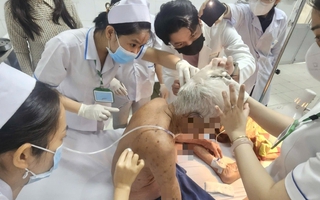 Cụ ông 74 tuổi ở Đồng Tháp bị ong đốt hơn 100 mũi đã tử vong