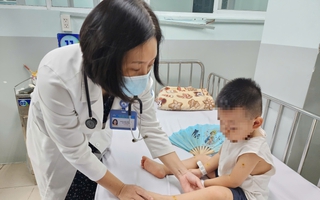 Hơn 1.500 ca mắc tay chân miệng ở TPHCM trong 1 tuần