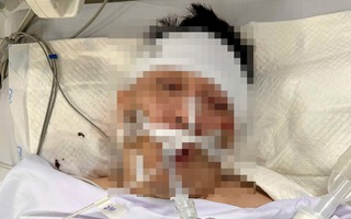 Tìm thân nhân người đàn ông bị tai nạn giao thông nặng đang cấp cứu trong bệnh viện