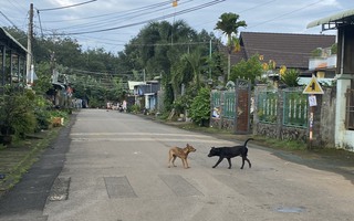 Nam thanh niên không uống được nước, không chịu được tiếng ồn và tử vong sau 20 ngày bị chó cắn