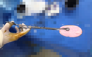 Bé gái đi cấp cứu vì nhét xà phòng vào vùng kín lúc đang tắm