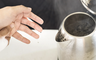 Bé 9 tháng tuổi bỏng 30% cơ thể do kéo dây nguồn ấm siêu tốc