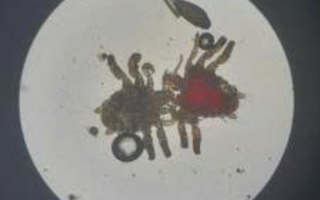 Ngứa dữ dội “vùng kín”, người đàn ông phát hiện điều không ngờ