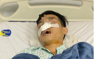 Công an khẩn trương vào cuộc vụ một người bị đánh gãy mũi ở Chợ đầu mối Hóc Môn