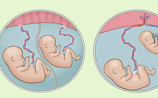 Bé trai nặng chưa đầy 1 kg được cứu sống thần kỳ