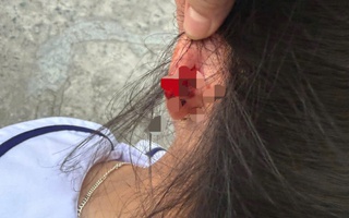 Xác minh vụ cô giáo ở Phú Quốc nhéo tai học sinh lớp 1 đến chảy máu