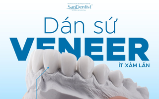 Làm đẹp nụ cười trước Tết: Xu hướng Veneer an toàn được nhiều người lựa chọn