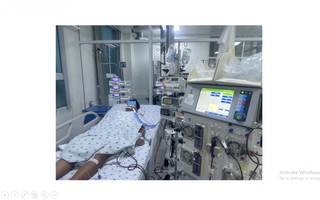 Biến chứng hiếm gặp của căn bệnh do muỗi cắn, thế giới chỉ có 70 ca