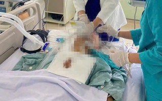 Đang ăn cỗ, cụ ông phải đi tỷ lệ bóng đá kèo nhà cái