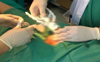 Tưởng bệnh tình dục phổ biến, ai ngờ là ung thư dương vật