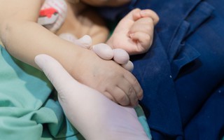 Ca ghép gan đặc biệt cứu bé 8 tháng tuổi
