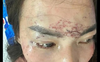 Khởi tố vụ bắt người phụ nữ đem về xăm, cắt tóc và đánh đập gây chấn động dư luận ở Cà Mau