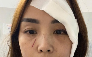 Một phụ nữ ở Nha Trang tố cáo "bị người không quen biết rạch mặt"