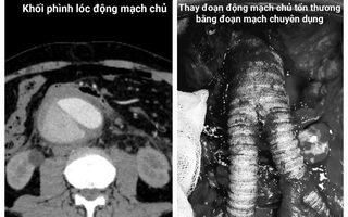 Du khách nước ngoài nguy kịch, bác sĩ Việt cứu sống ngoạn mục