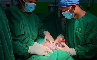 Bé gái ở Quảng Nam chào đời với dây rốn quấn quanh cổ đến 4 vòng