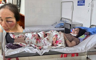 Làm rõ việc tiểu thương tố bị hành hung