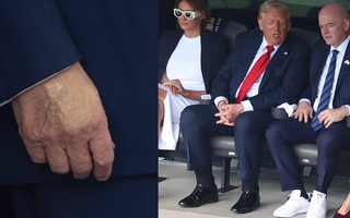 Nhà Trắng thông báo Tổng thống Donald Trump mắc suy tĩnh mạch mạn tính