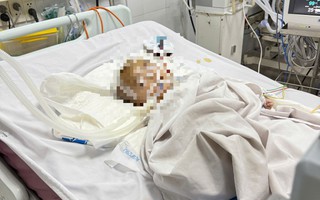 Bé trai xuất huyết não bất thường khi gửi ở nhóm nhà trẻ tự phát