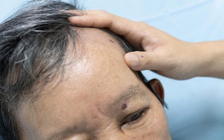 Người đàn ông ở Đà Nẵng bị ong đốt đến hôn mê, suýt chết