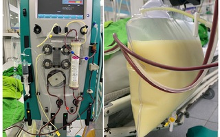 Chỉ nặng 45 kg, người phụ nữ vẫn có mỡ máu cao bất thường
