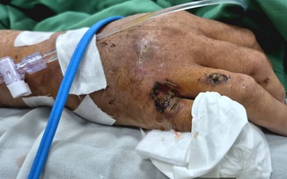 Sửa bồn nước, người đàn ông bị điện giật ngừng tim