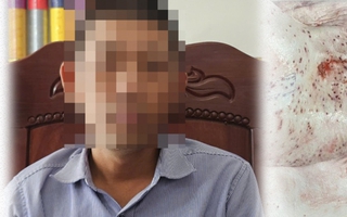Vụ công an triệu tập người từng “tố” Công ty C.P. Việt Nam: Tình tiết pháp lý liên quan ông L.Q.N