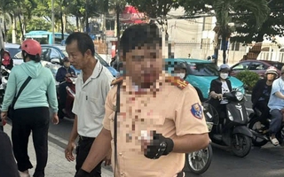 Một cảnh sát giao thông bị thanh niên người Nga tấn công ở Nha Trang