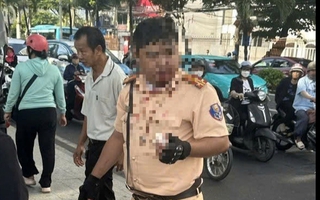 Phân định pháp lý vụ một Trung tá CSGT bị thanh niên người Nga tấn công