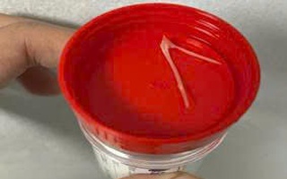 Hai người đi cấp cứu vì nuốt cả xương khi ăn