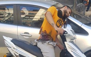 Đòn tấn công của Israel khiến hàng ngàn tay súng Hezbollah không thể hồi phục hoàn toàn