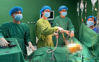 Một học sinh lớp 7 bị đâm nguy kịch trong sân trường
