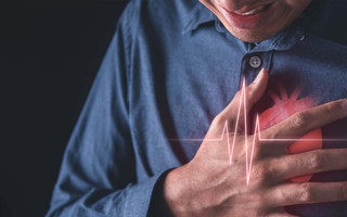 Phát hiện thêm nguyên nhân gây nhồi máu cơ tim