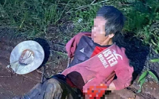Bị người bệnh thần kinh dùng đá đập đầu, một thanh niên nguy kịch