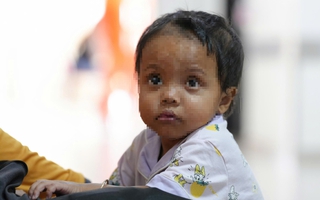 Bé gái bị nhiễm độc từ chính mình, đi 6 bệnh viện không phát hiện ra