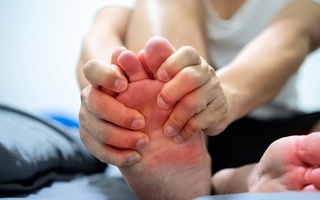 Làm sao để ngăn ngừa gout cấp tái phát?