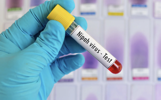 TPHCM tăng cường giám sát nhập cảnh, kiểm soát dịch bệnh Nipah